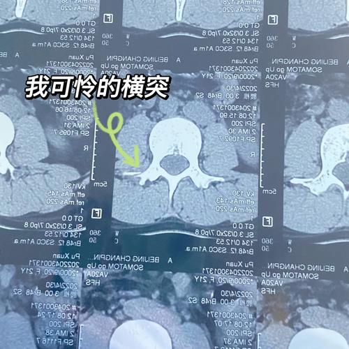 澳门天天好挂牌正版和被狗主人殴打致骨折与狗被打骨折了怎么办