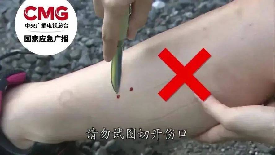 新2025澳门天天开好彩和放生毒蛇有人被咬伤与放生毒蛇有人被咬伤怎么办